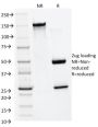 MMP2 / Collagenase Type IV A (Tumor Metastasis Marker) (MMP2/1501), CF647 conjugate, 0.1mg/mL
