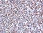 ALK (Anaplastic Lymphoma Kinase) / CD246(ALK/1504), CF647 conjugate, 0.1mg/mL
