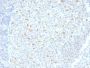 Bcl-6 (Follicular Lymphoma Marker) (BCL6/1526), CF647 conjugate, 0.1mg/mL