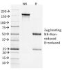 Bcl-6 (Follicular Lymphoma Marker) (BCL6/1526), CF647 conjugate, 0.1mg/mL