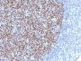 Bcl-6 (Follicular Lymphoma Marker) (BCL6/1527), CF647 conjugate, 0.1mg/mL