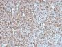 Bcl-6 (Follicular Lymphoma Marker) (BCL6/1527), CF647 conjugate, 0.1mg/mL