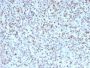 Bcl-6 (Follicular Lymphoma Marker) (BCL6/1527), CF647 conjugate, 0.1mg/mL