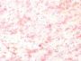 Tyrosinase-Related Protein-1 (TYRP-1) (Melanoma Marker) (TYRP1/1564R), CF647 conjugate, 0.1mg/mL