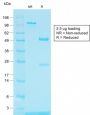 Tyrosinase-Related Protein-1 (TYRP-1) (Melanoma Marker) (TYRP1/1564R), CF647 conjugate, 0.1mg/mL