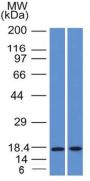 GCDFP-15 (Gross Cystic Disease Fluid Protein 15) (Breast Marker) (PIP/1571), CF647 conjugate, 0.1mg/mL