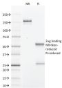 GCDFP-15 (Gross Cystic Disease Fluid Protein 15) (Breast Marker) (PIP/1571), CF647 conjugate, 0.1mg/mL