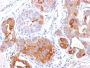 GCDFP-15 (Gross Cystic Disease Fluid Protein 15) (Breast Marker) (PIP/1571), CF647 conjugate, 0.1mg/mL
