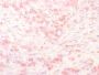 Tyrosinase-Related Protein-1 (TYRP-1) (Melanoma Marker), CF647 conjugate, 0.1mg/mL
