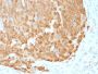 S100A1 (Melanoma Marker)(S100A1/1942), CF647 conjugate, 0.1mg/mL