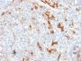 NGF-Receptor (p75) / CD271 (Soft Tissue Tumor Marker) (NGFR/1997R), CF647 conjugate, 0.1mg/mL