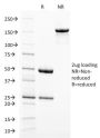 gp100 / Melanosome / PMEL17 / SILV (Melanoma Marker) (PMEL/2038), CF647 conjugate, 0.1mg/mL