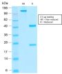 Thrombomodulin / CD141 (Endothelial Cell Marker) (rTHBD/1591), CF647 conjugate, 0.1mg/mL