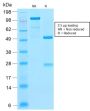 Ferritin, Light Chain (FTL) (Microglia Marker) (FTL/2338R), CF647 conjugate, 0.1mg/mL