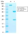 CD44v9 (Marker of Tumor Metastasis) (rCD44v9/1459), CF647 conjugate, 0.1mg/mL