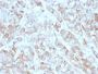 CD269 / TNFRSF17 / BCMA (B-Cell Maturation Protein) (BCMA/2366), CF647 conjugate, 0.1mg/mL