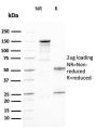CD25 / IL2RA (Activated Lymphocyte Marker)(IL2RA/2394), CF647 conjugate, 0.1mg/mL