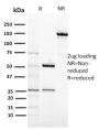 CD117 / c-Kit (Marker for Gastrointestinal Stromal Tumors)(KIT/2674), CF647 conjugate, 0.1mg/mL