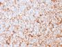 Mammaglobin (SCGB2A2) (Breast Cancer Marker)(MGB1/2682R), CF647 conjugate, 0.1mg/mL