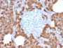 Carboxypeptidase A1 / CPA1 (Pancreatic Cancer Marker)(CPA1/2714), CF647 conjugate, 0.1mg/mL