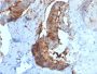 Cathepsin D (Tumor Marker)(CTSD/2781), CF647 conjugate, 0.1mg/mL