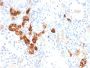 Calbindin 1 (CALB1)(CALB1/2782), CF647 conjugate, 0.1mg/mL