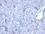 AKT1 (Prognostic Marker for Neuroendocrine Tumors)(AKT1/2784), CF647 conjugate, 0.1mg/mL