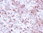 Cathepsin K (Marker of Tumor Invasiveness)(CTSK/2791), CF647 conjugate, 0.1mg/mL