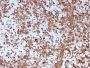 Cathepsin K (Marker of Tumor Invasiveness)(CTSK/2792), CF647 conjugate, 0.1mg/mL