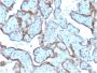 MMP3 (Marker of Metastasis and Rheumatoid Arthritis)(MMP3/2806), CF647 conjugate, 0.1mg/mL
