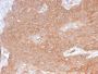Spectrin beta III (SPTBN2) (SPTBN2/2894R), CF647 conjugate, 0.1mg/mL