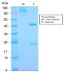 EGFR (Epidermal Growth Factor Receptor) (GFR/2968R), CF647 conjugate, 0.1mg/mL