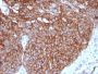 GLUT-1 (Tumor Progression and Mesothelioma Marker)(GLUT1/3132R), CF647 conjugate, 0.1mg/mL