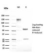 Alpha-1-Antitrypsin (SERPINA1) (Hepatocellular & Histiocytic Marker)(AAT/3167R), CF647 conjugate, 0.1mg/mL