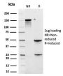 Cytokeratin 6A (KRT6A) (Basal Cell Marker)(rKRT6A/2100), CF647 conjugate, 0.1mg/mL