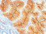 TAG-72 / CA72.4(B72.3), CF568 conjugate, 0.1mg/mL