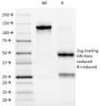 ALK (Anaplastic Lymphoma Kinase) / CD246(ALK/1032), CF568 conjugate, 0.1mg/mL