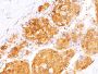 Arginase 1 (Hepatocellular Carcinoma Marker)(ARG1/1125+ ARG1/1126), CF568 conjugate, 0.1mg/mL