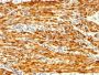 Calponin-1 (Smooth Muscle Marker) (CNN1/1408R), CF568 conjugate, 0.1mg/mL