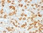 CD30 / TNFRSF8 (Hodgkin & Reed-Sternberg Cell Marker) (Ki-1/1505R), CF568 conjugate, 0.1mg/mL