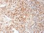 HSV1 (Herpes Simplex Virus Type I)(HSVI/2095), CF568 conjugate, 0.1mg/mL