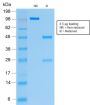 Cytokeratin 19 (KRT19) (Pancreatic Stem Cell Marker) (rKRT19/799), CF568 conjugate, 0.1mg/mL
