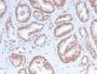 ATRX / RAD54 (Alpha Thalassemia Mental Retardation) (ATRX/2900R), CF568 conjugate, 0.1mg/mL