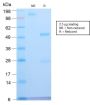 ATRX / RAD54 (Alpha Thalassemia Mental Retardation) (ATRX/2900R), CF568 conjugate, 0.1mg/mL