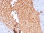 Fodrin / Alpha Spectrin II (SPTAN1) / NEAS(SPTAN1/3352), CF568 conjugate, 0.1mg/mL