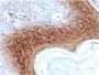 Involucrin (Squamous Cell Terminal Differentiation Marker)(rIVRN/827), CF568 conjugate, 0.1mg/mL