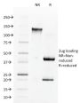 Angiotensin I Converting Enzyme (ACE) / CD143(9B9), CF740 conjugate, 0.1mg/mL