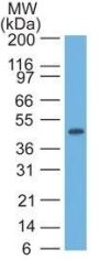 Cytokeratin 17(E3), CF488A conjugate, 0.1mg/mL