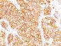 Renal Cell Carcinoma (Carbonic Anhydrase IX)(66.4.C2), CF488A conjugate, 0.1mg/mL