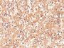 AFP (Alpha Fetoprotein)(C3), CF488A conjugate, 0.1mg/mL